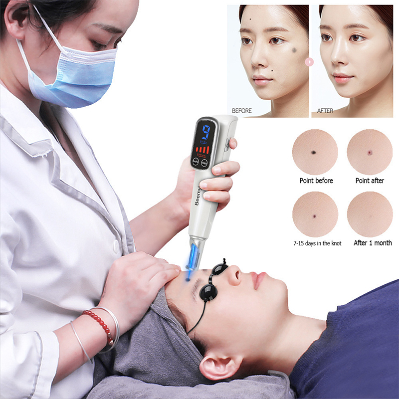 # เครื่องเลเซอร์พิโคเซคอนด์แบบ - Picosecond Laser Freckle Mole Remover บทวิจารณ์และราคา