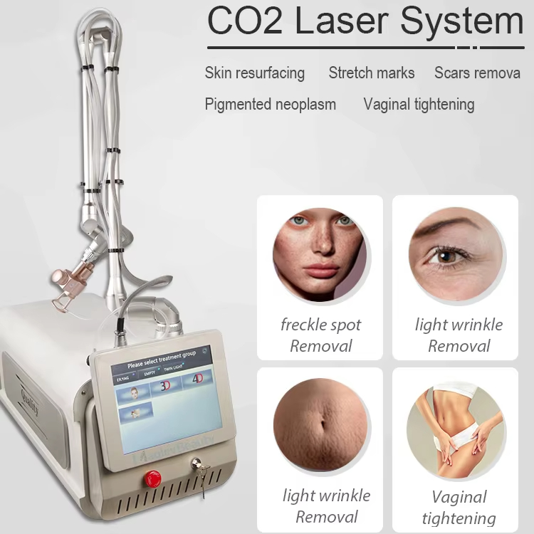 เครื่องเลเซอร์ CO2 แบบพกพา 106 - Laser Skin Resurfacing Machine บทวิจารณ์และราคา