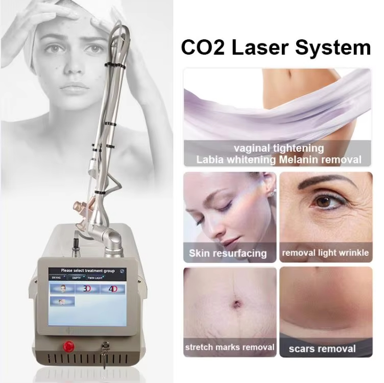 เครื่องเลเซอร์ CO2 แบบพกพา 106 - Laser Skin Resurfacing Machine บทวิจารณ์และราคา