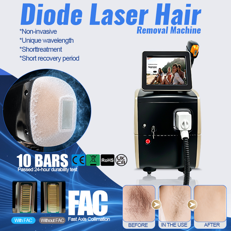 เครื่องกำจัดขนด้วยเลเซอร์ 5 คล - Laser Hair Removal Diode 808 บทวิจารณ์และราคา