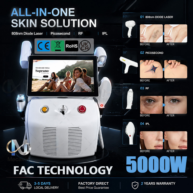เครื่องกำจัดขน 4IN1 Soprano Ti - Laser Hair Removal Diode 808 บทวิจารณ์และราคา