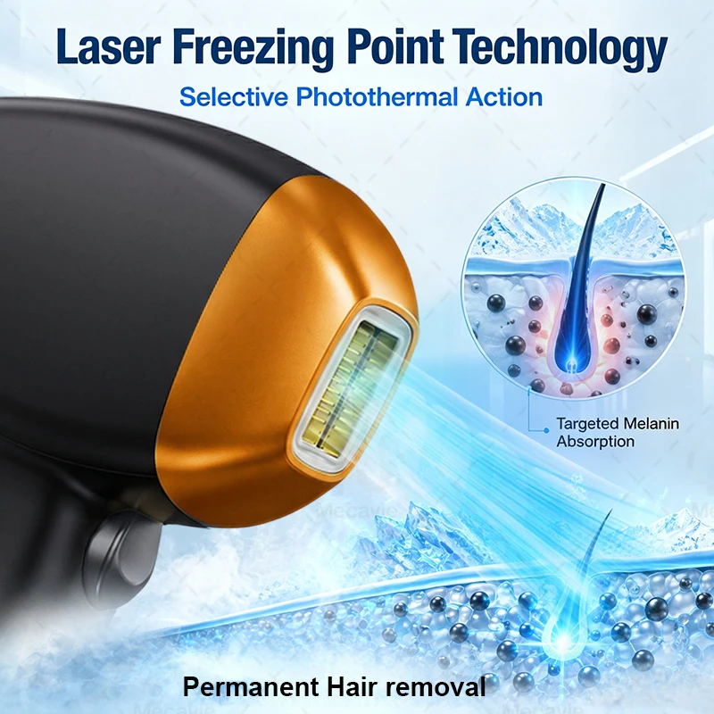 เครื่องกำจัดขนด้วยเลเซอร์ไดโอด - Laser Hair Removal Diode 808 บทวิจารณ์และราคา