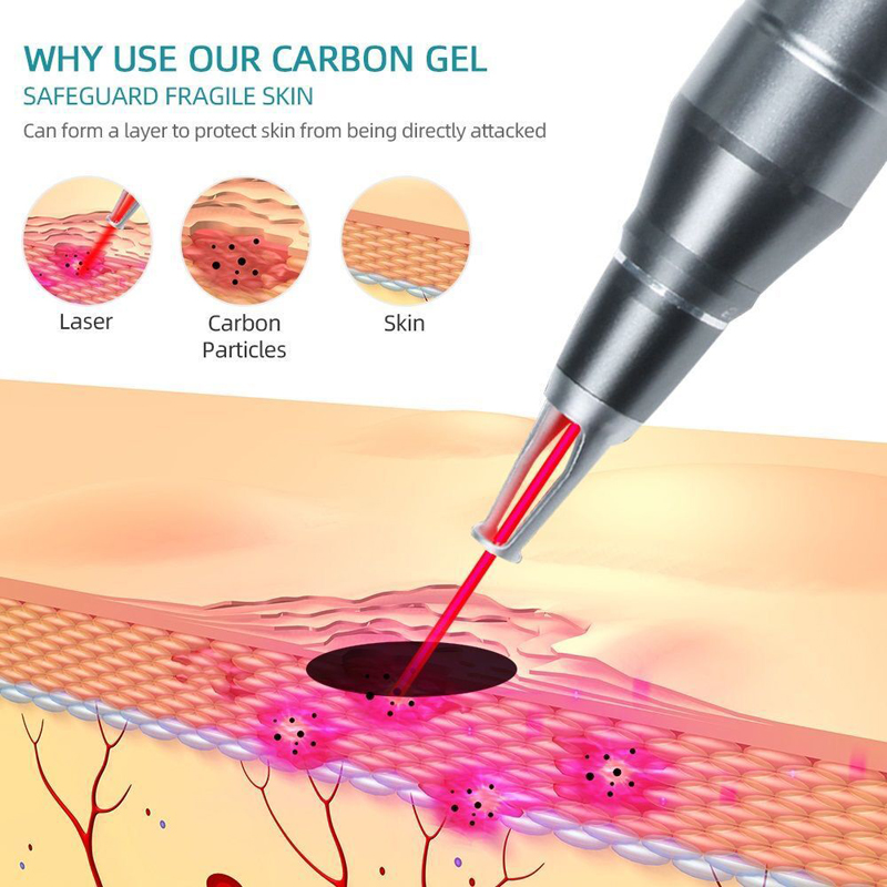 10PCS 5PCS 2PCS 1PCS ปลอดภัยคา - Laser Carbon Peel Cream Gel 80Ml บทวิจารณ์และราคา