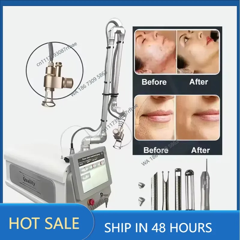 เครื่องเลเซอร์คาร์บอนไดออกไซด์ - Laser Skin Resurfacing Machine บทวิจารณ์และราคา
